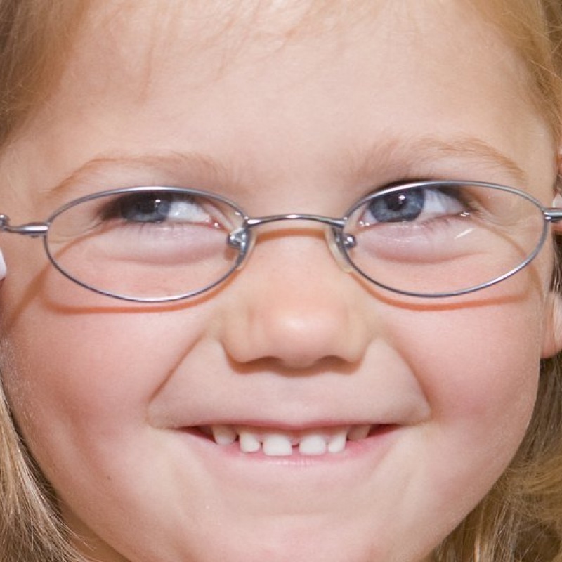 Нистагм зрение. Спонтанный горизонтальный нистагм. Нистагм зрение. Ротаторный нистагм. Что такое горизонтальный нистагм глаз.