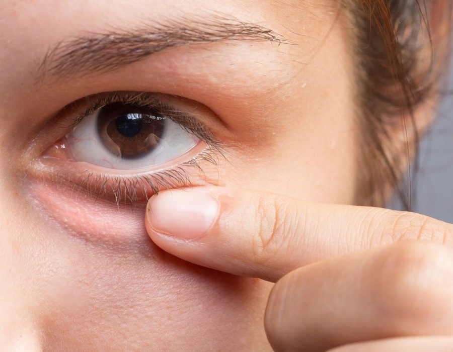 Почему болят внутренние уголки глаз