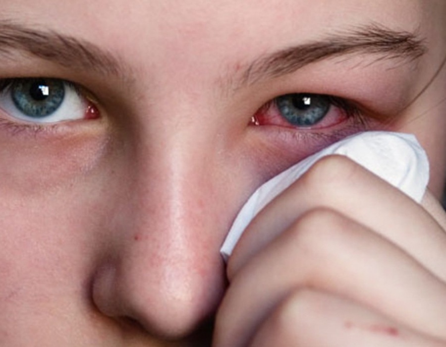 Боль в глазах: Когда боль в глазах — это неотложная ситуация?