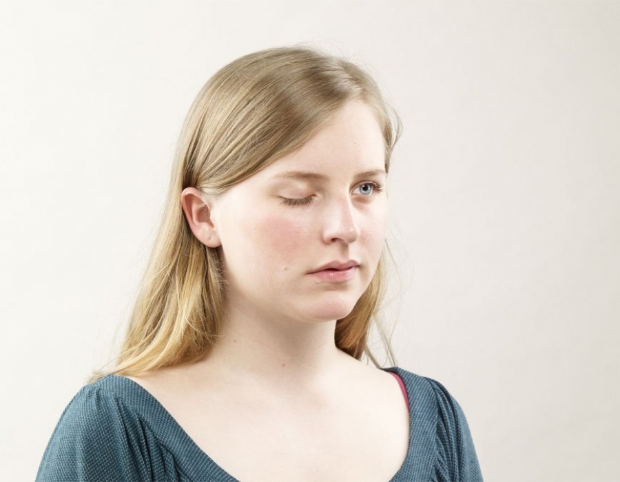 Лечение синдрома Маркуса Гунна